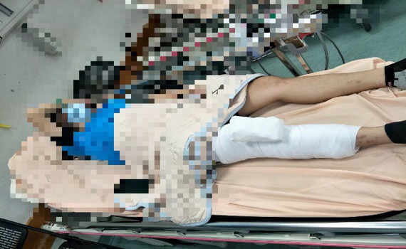 獨家/台南國三生遭霸凌骨折 學校疑吃案還施壓教職員