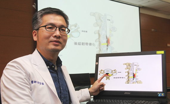 東亞隱形殺手「頸椎後縱韌帶骨化症」 男性發病率較高