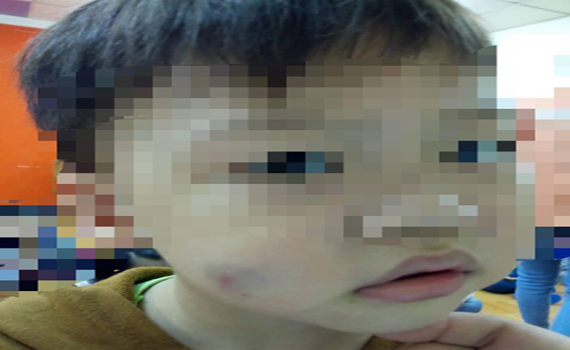 台南永康幼兒園虐童是累犯? 2年前就有案例