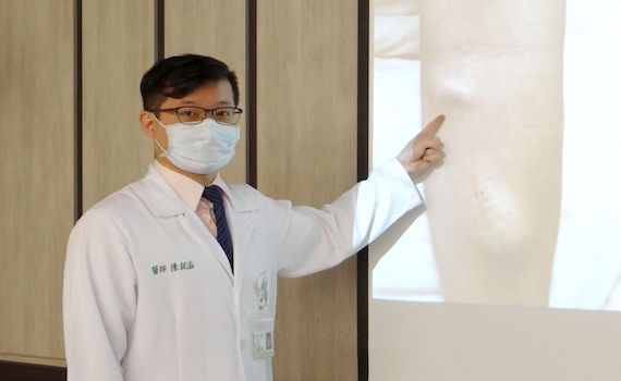 跨領域醫療團隊合作 提升洗腎瘻管照護品質