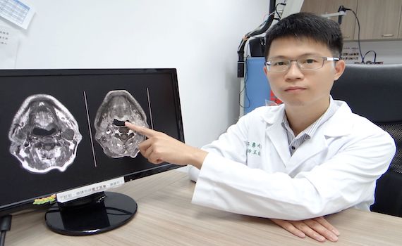 「喉嚨卡卡」勿亂猜 儘速就醫為良策