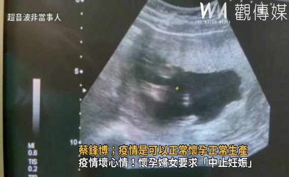 影/疫情壞心情!懷孕婦女到婦產科要求「中止妊娠」