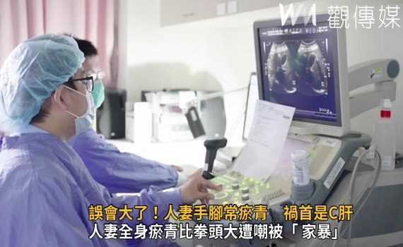影/誤會大了!人妻手腳常瘀青 禍首是C肝