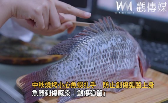 影/魚鰭刺傷感染「創傷弧菌」 8旬嬤壞死性筋膜炎險喪命