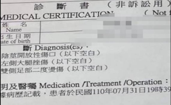 冷血保母 4歲小男童下體被剪傷腳掌疑似燙傷潰爛 正義哥臉書直播揭暴行