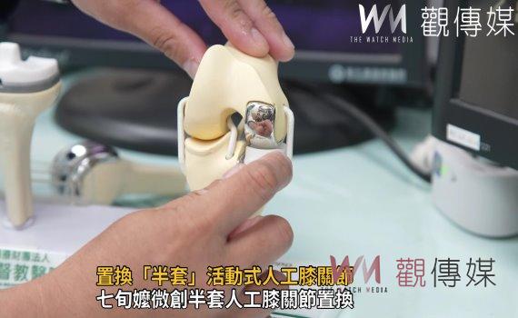 影/置換「半套」活動式人工膝關節 阿嬤行動不在受限