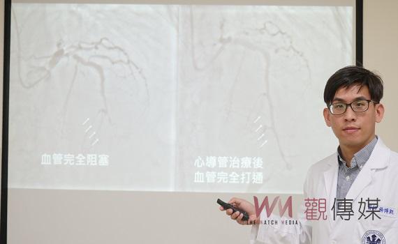 成大斗六分院引進新型心導管機 醫師:心導管治療的潛在風險,有解