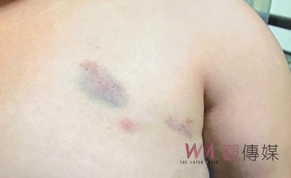 台南歸仁幼兒園女師捏童挨告 二審逆轉判有罪