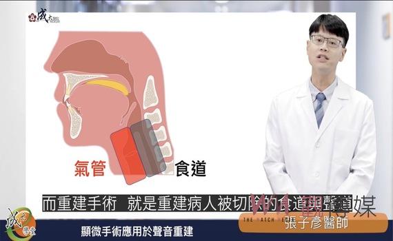 成醫顯微重建手術 助喉癌患者重拾說話與進食功能