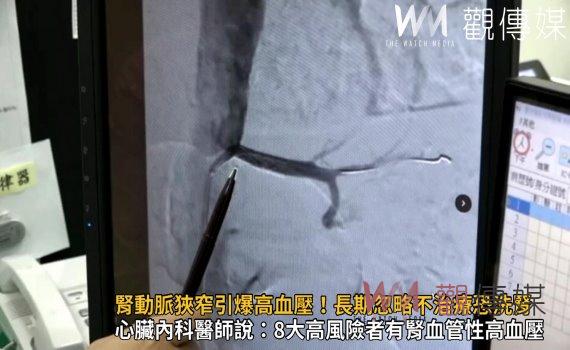 影/腎動脈狹窄引爆高血壓!長期忽略不治療恐洗腎