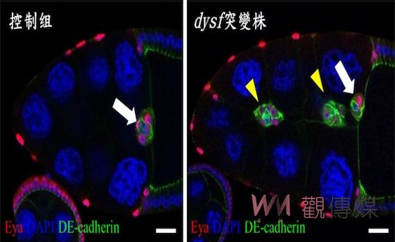 成大團隊透過果蠅基因研究 發現細胞遷移及癌症轉移關鍵