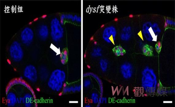 成大團隊透過果蠅基因研究    發現細胞遷移及癌症轉移關鍵 