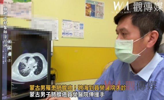 影/得肺癌有救嗎?蒙古男罹患肺腺癌!跨海員榮醫院求診