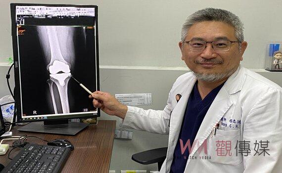 膝關節疼痛苦不堪言「MAKO機器人手臂人工關節置換術」舒適耐用患者福音