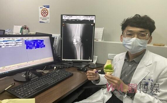 減少破壞性！人工膝關節翻修 取自體骨移植技術　患者重獲新生