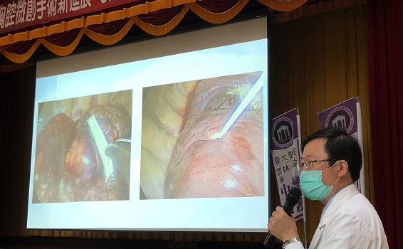 臺大雲林分院引進冷凍微針治療　肺腫瘤胸腔微創新進展 - https://www.watchmedia01.com