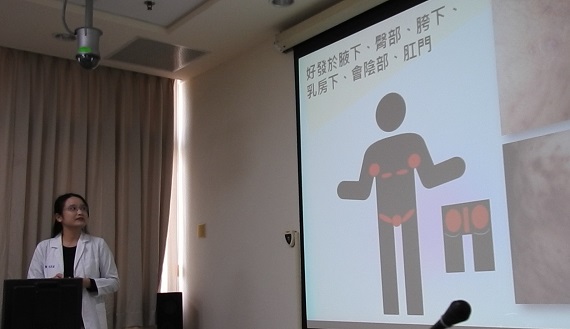 腋窩臀部反覆腫痛長疔瘡　小心「化膿性汗腺炎」纏身 - https://www.watchmedia01.com