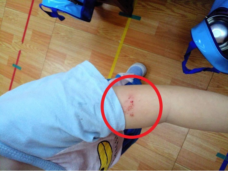 台南永康幼兒園虐童是累犯？　2年前就有案例 - https://www.watchmedia01.com
