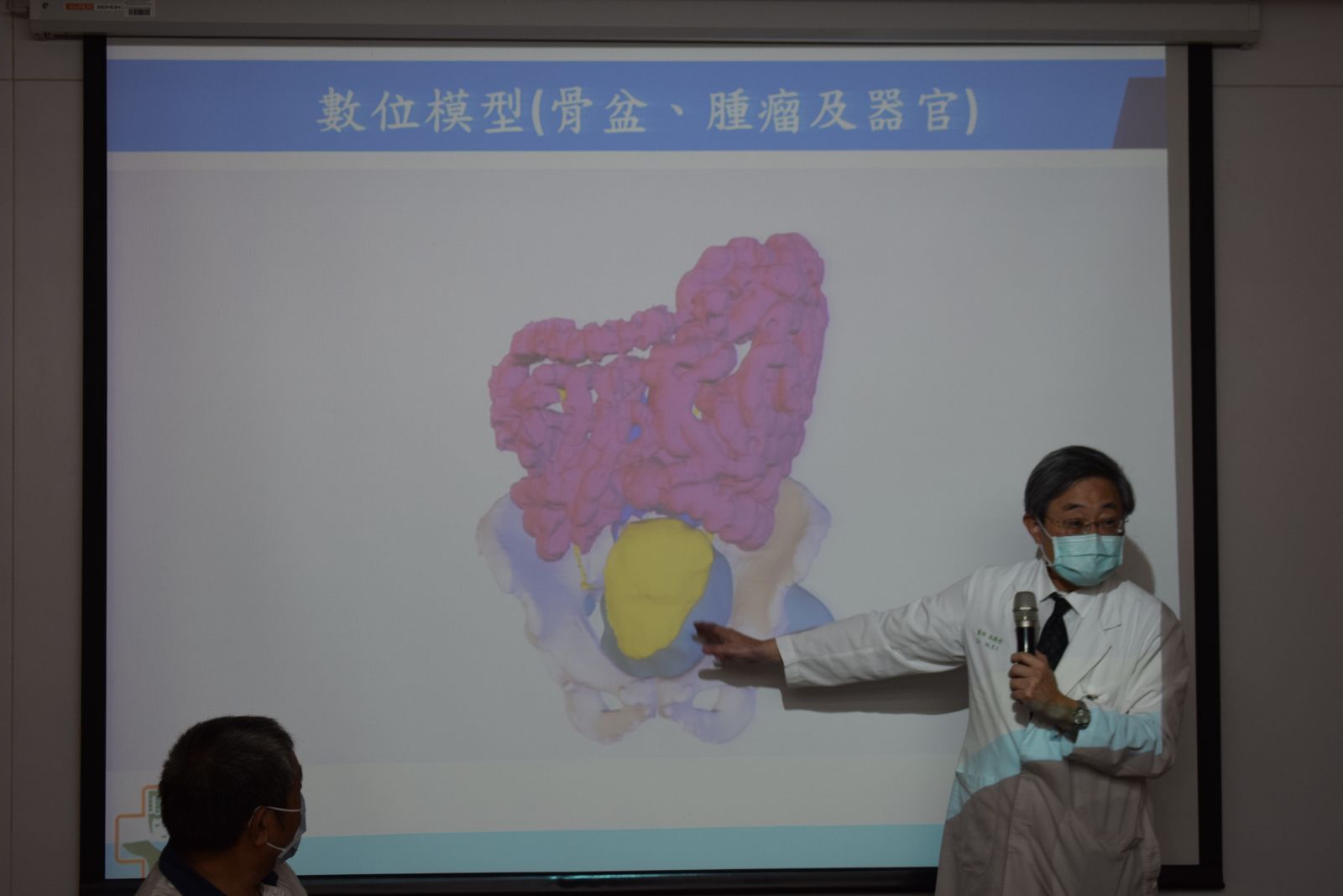 影／罕見骨盆腔巨大腫瘤 北媽多科團隊接力3D清除 - https://www.watchmedia01.com