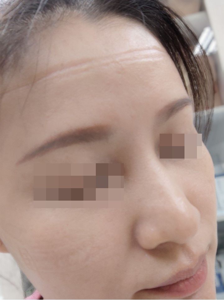 口罩護目鏡戴整天壓花臉 護理師提供小撇步防壓 - https://www.watchmedia01.com