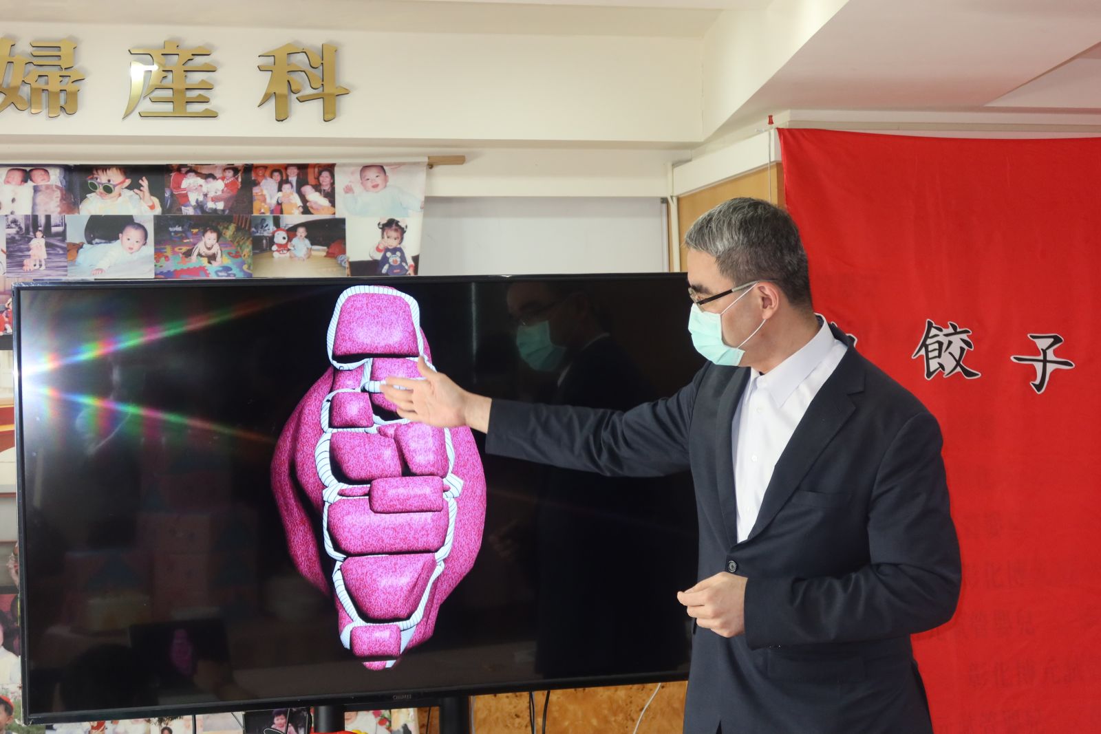影／產婦植入性胎盤死亡率高　包餃子縫合法成功搶救 - https://www.watchmedia01.com