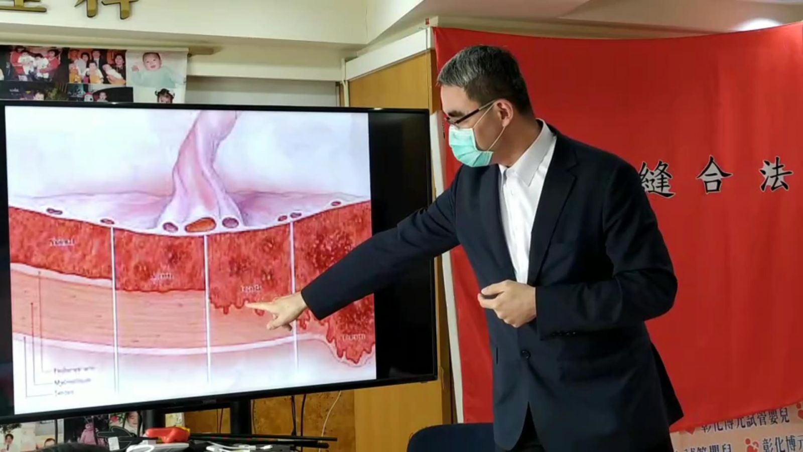 影／產婦植入性胎盤死亡率高　包餃子縫合法成功搶救 - https://www.watchmedia01.com