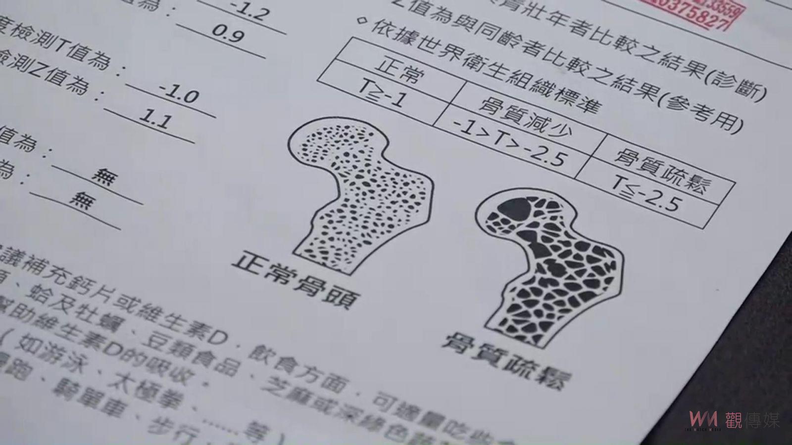 影/老骨定空空? 彰化醫院骨鬆團隊進社區解說助就醫 - https://www.watchmedia01.com