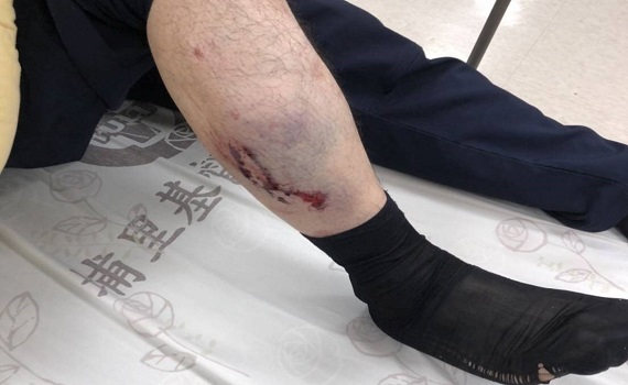 員警執勤意外受傷案(獲報處理車禍遭肇事車輛爆胎波及) - https://www.watchmedia01.com