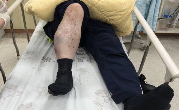 員警執勤意外受傷案(獲報處理車禍遭肇事車輛爆胎波及) - https://www.watchmedia01.com
