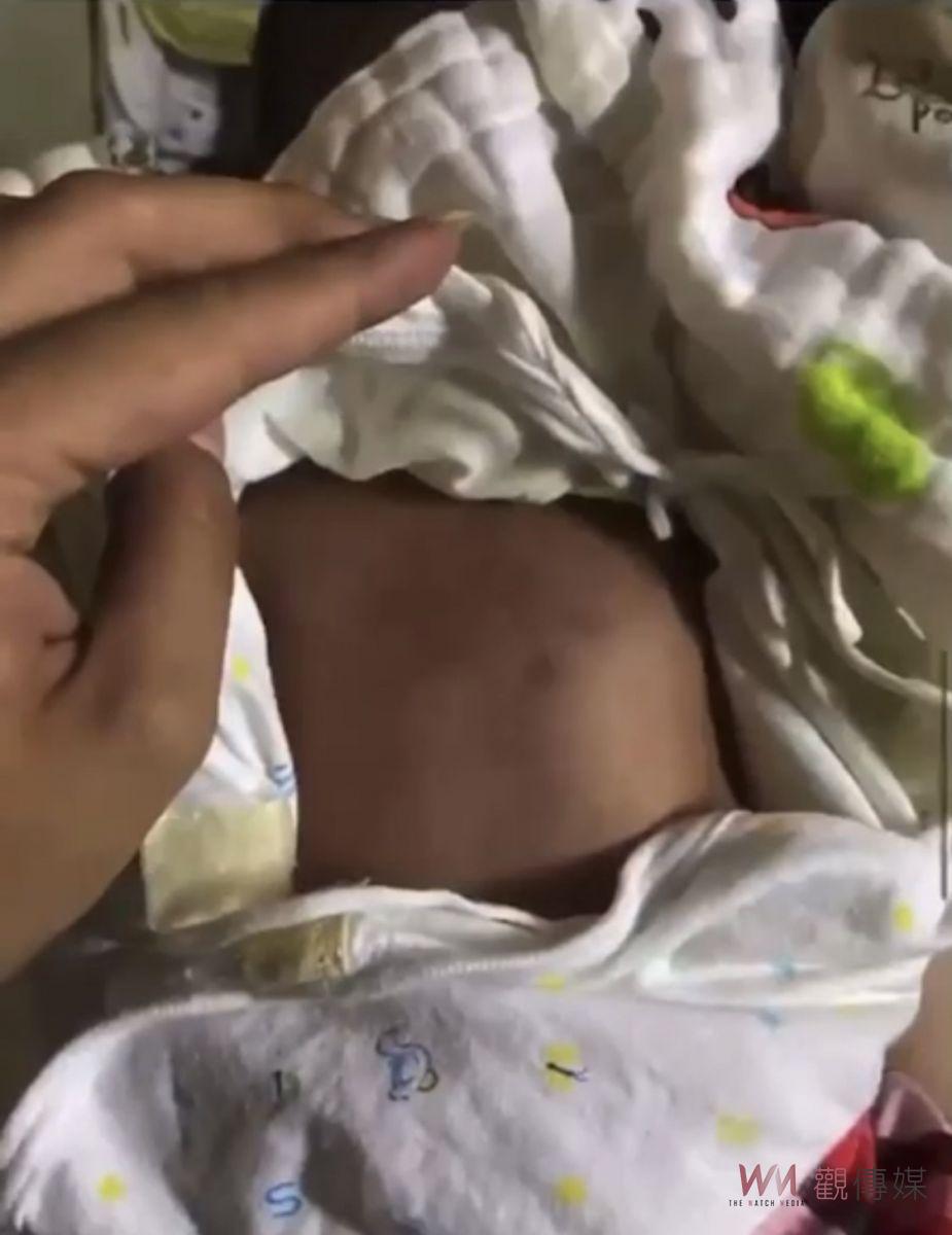 人神共憤！甫滿月男嬰被狂毆 肝指數過高疑遭餵毒 - https://www.watchmedia01.com