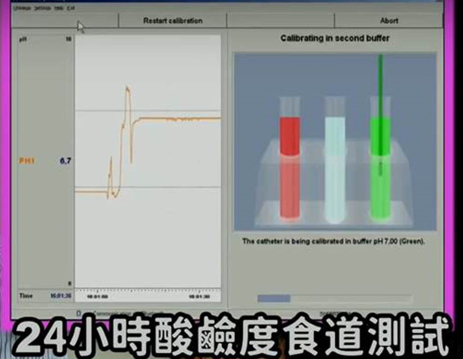 克服胃食道逆流　內視鏡手術擺脫藥物依賴 - https://www.watchmedia01.com