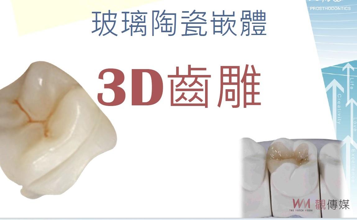 牙齒斷掉了！怎麼辦？　成大提供玻璃陶瓷嵌體修復 - https://www.watchmedia01.com