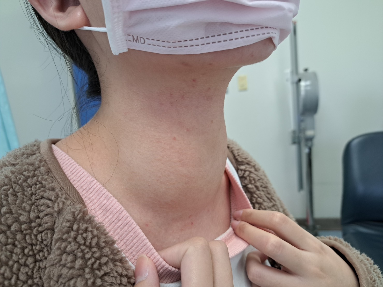 複合式無痕甲狀腺亢進手術切除 榮獲國際期刊認證 - https://www.watchmedia01.com