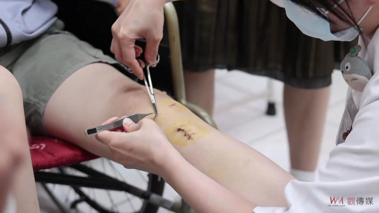 影／蒙古少女膝關節十字韌帶斷裂　員榮醫院骨科讓她重回運動場 - https://www.watchmedia01.com