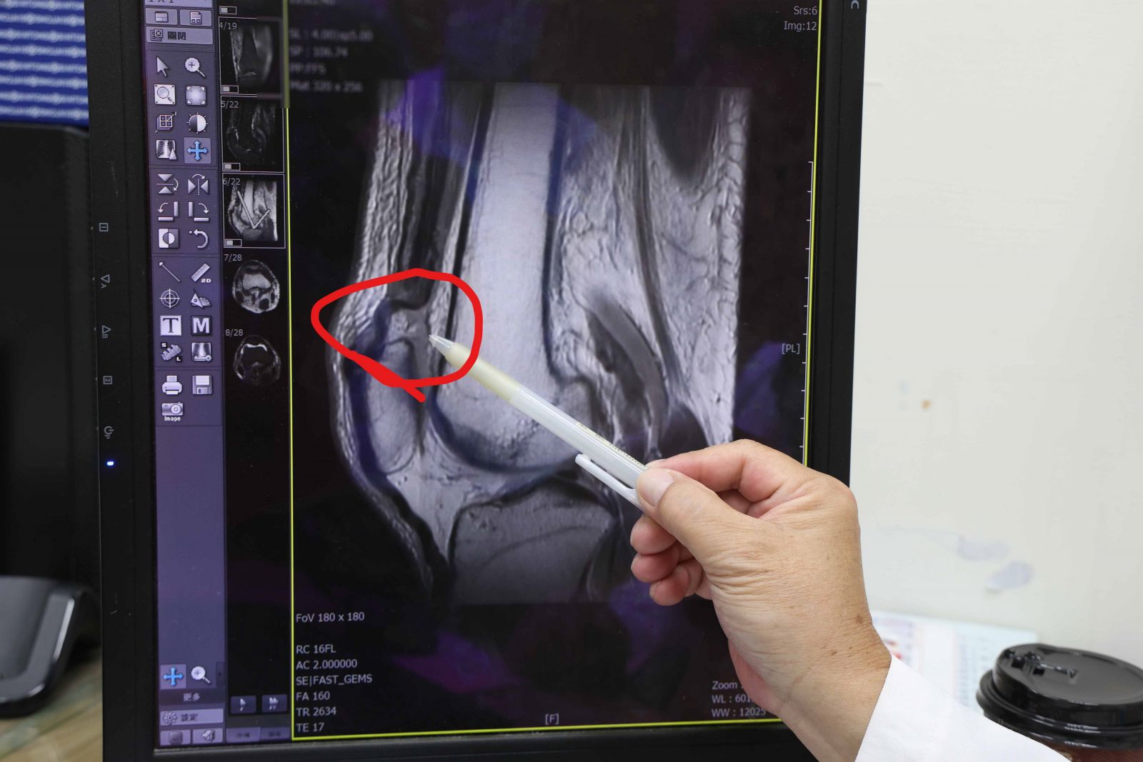 登山翁和舉重女神「傷同處」員榮醫院助他重新站起來 - https://www.watchmedia01.com