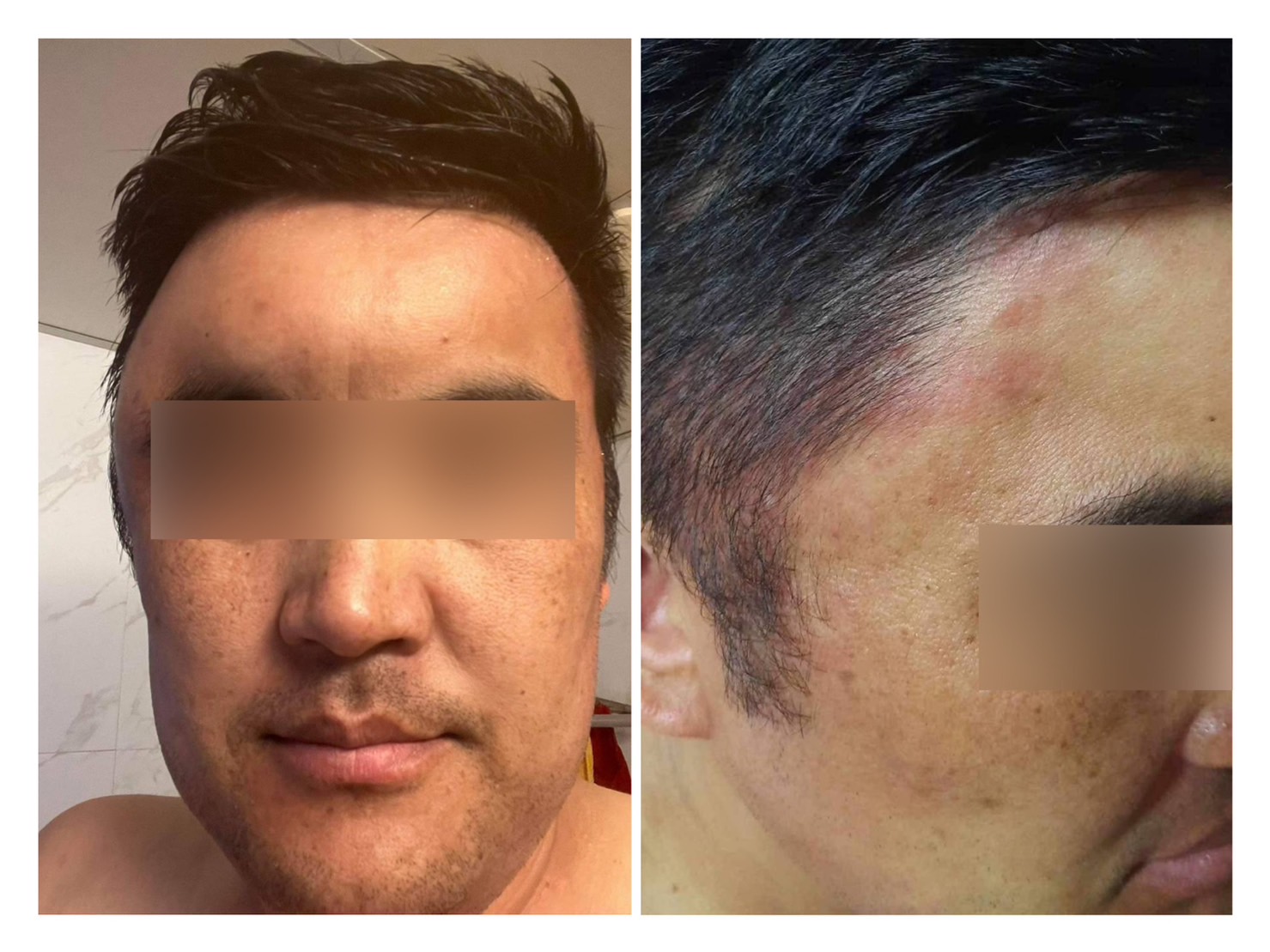 影／得肺癌有救嗎？蒙古男罹患肺腺癌！跨海員榮醫院求診 - https://www.watchmedia01.com