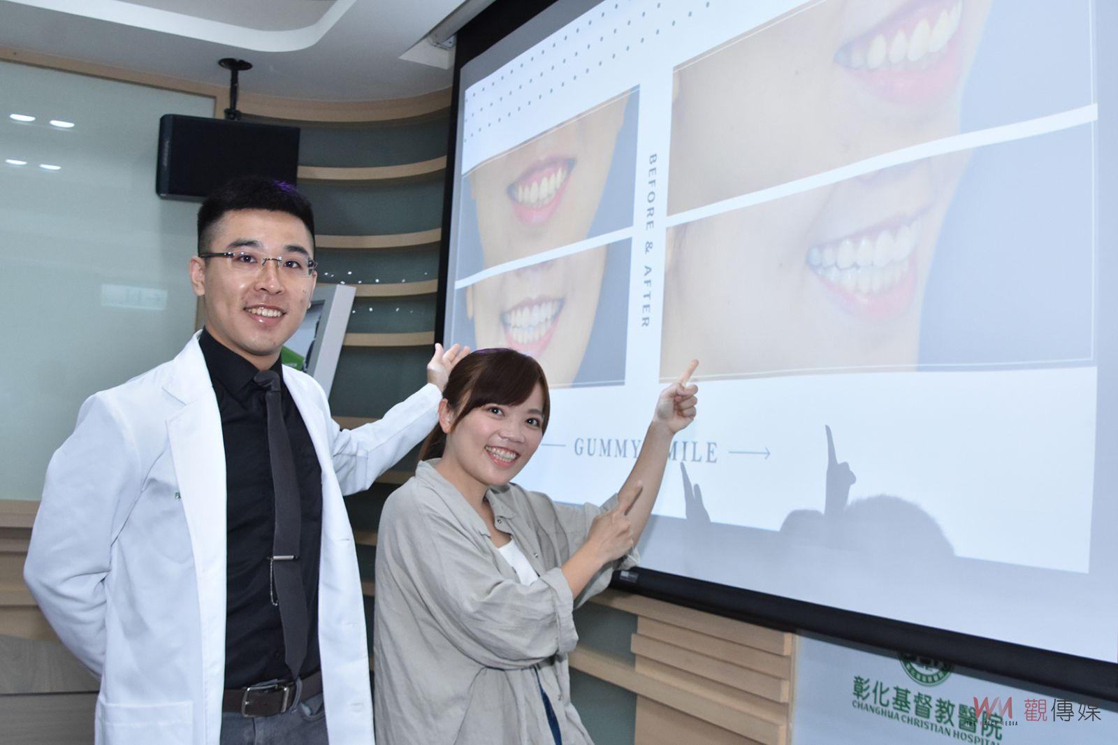 影／讓生活增添色彩　接受正顎手術女設計師開心展現燦爛笑容 - https://www.watchmedia01.com
