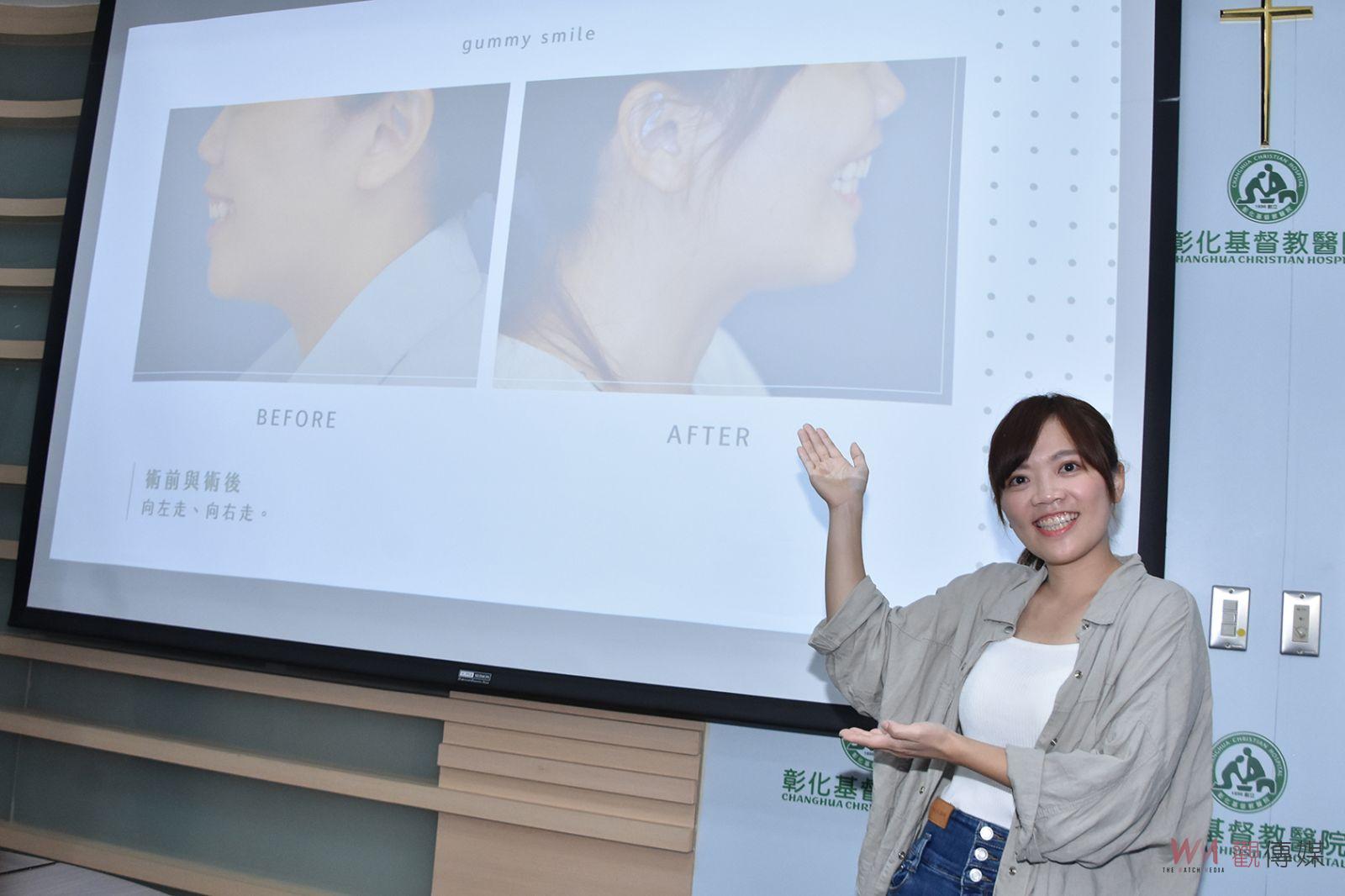 影／讓生活增添色彩　接受正顎手術女設計師開心展現燦爛笑容 - https://www.watchmedia01.com
