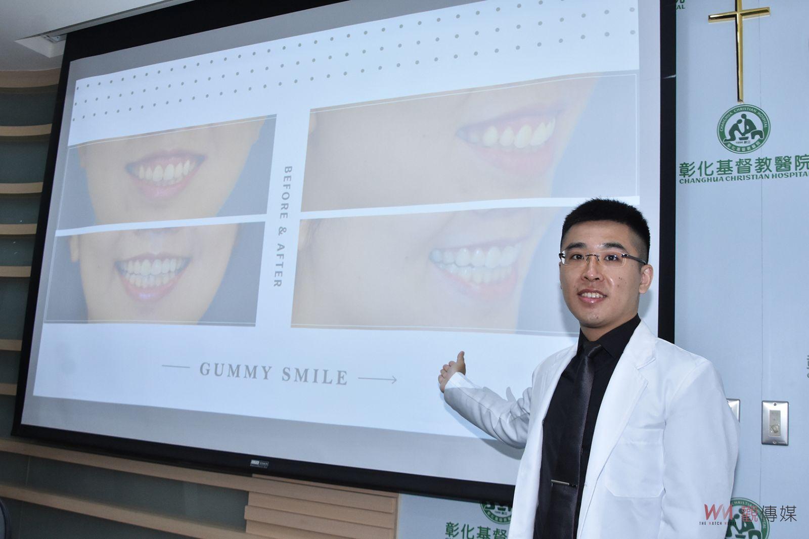 影／讓生活增添色彩　接受正顎手術女設計師開心展現燦爛笑容 - https://www.watchmedia01.com