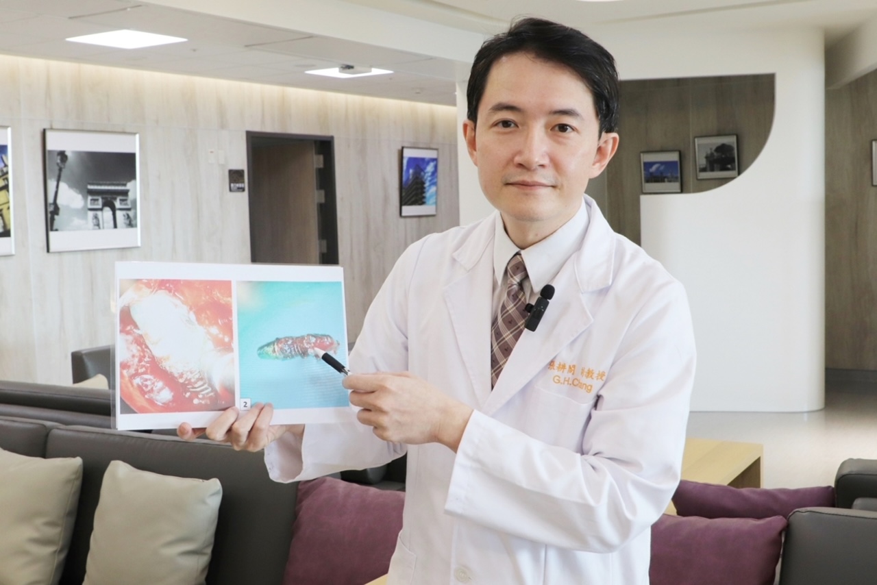 植牙體掉入併發反覆鼻竇炎 微創內視鏡手術無復發 - https://www.watchmedia01.com