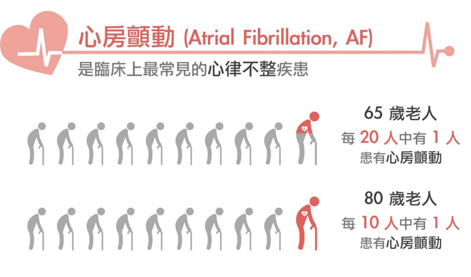 （有影片）／心房顫動致中風是一般人五倍　冷凍消融手術降低病人復發率 - https://www.watchmedia01.com