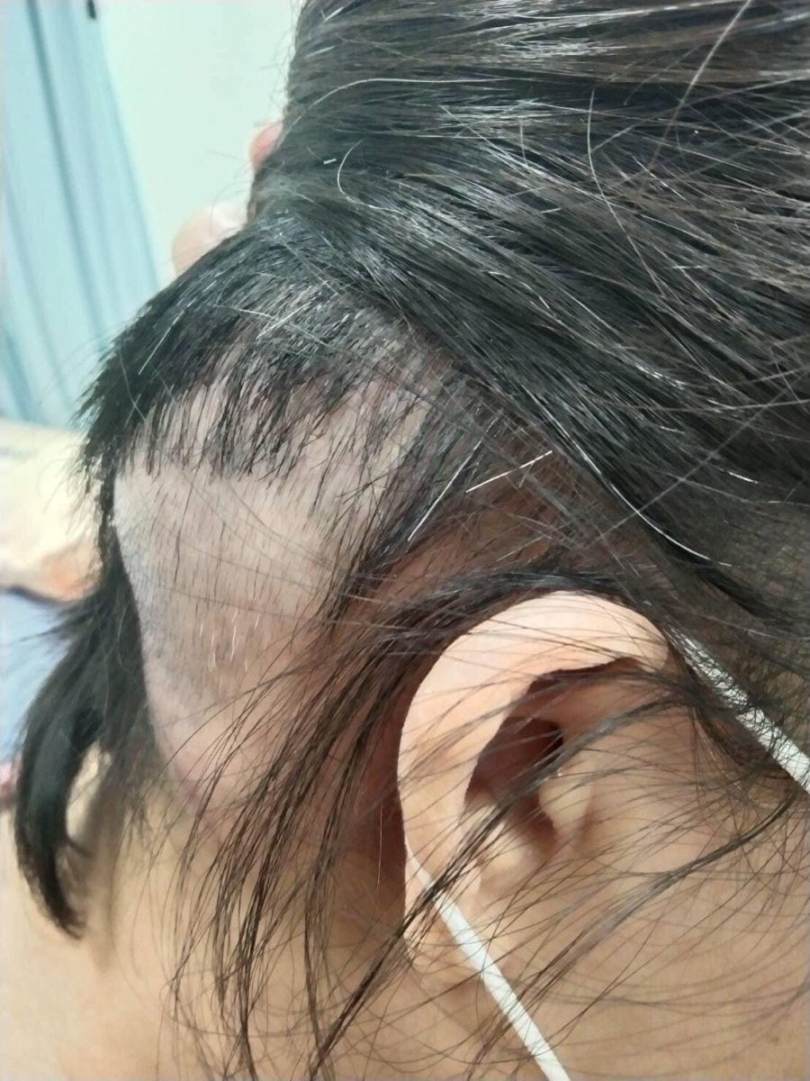 61歲女性罹患梅尼爾氏症竟是腦腫瘤+心臟罕見黏液瘤 全程奇蹟康復 - https://www.watchmedia01.com