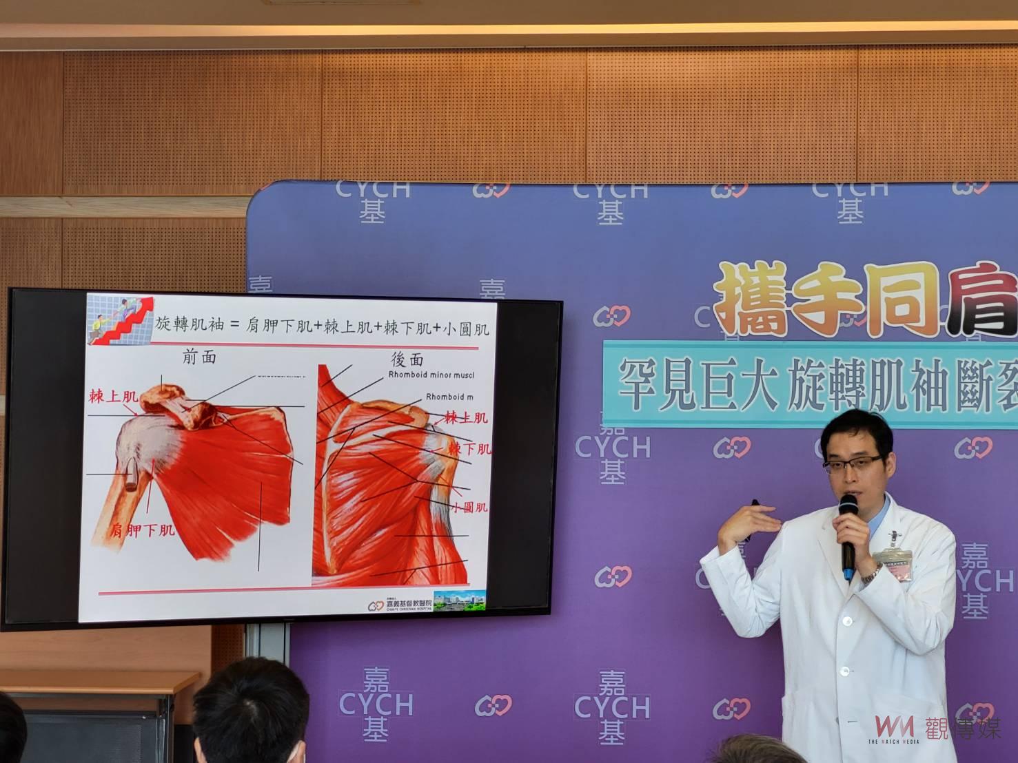 罕見巨大旋轉肌袖斷裂　肩關節鏡縫合恢復活動 - https://www.watchmedia01.com