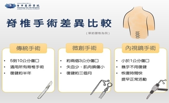 年輕移工下背部痛一年　中慈醫院：脊椎內視鏡手術治療 快速回職場 - https://www.watchmedia01.com