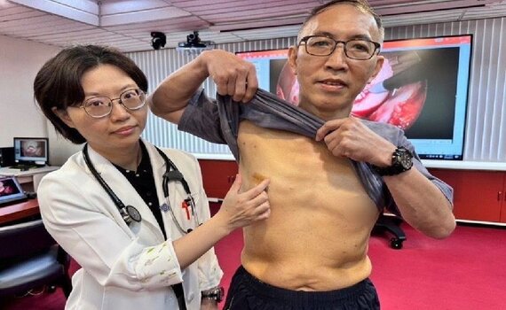 二尖瓣膜嚴重逆流！中榮醫院：內視鏡微創心臟手術　傷口小 恢復快 患者福音 - https://www.watchmedia01.com