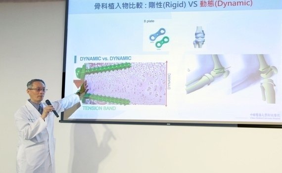 讓膝蓋不再打架　中醫大附醫：導引式手術重塑X型腿男童健康未來 - https://www.watchmedia01.com
