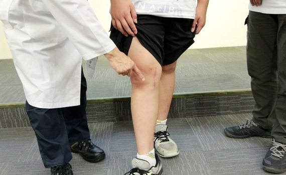 讓膝蓋不再打架　中醫大附醫：導引式手術重塑X型腿男童健康未來 - https://www.watchmedia01.com
