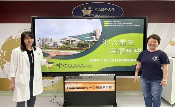精油女講師全身1/3燒燙傷　僅一個月順利出院 浴火重生歡顏展現 - https://www.watchmedia01.com