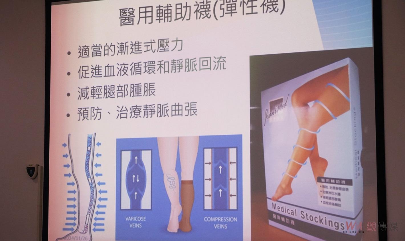 （有影片）／靜脈曲張浮腳筋不再煩惱！　微創雷射術助患者重拾健康生活 - https://www.watchmedia01.com