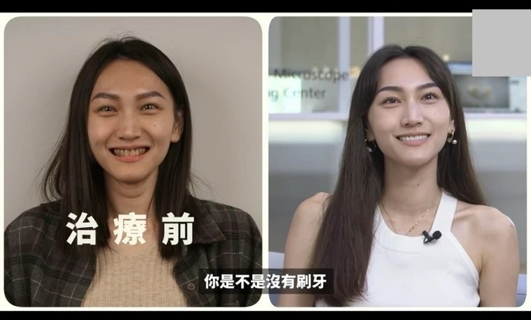妙齡女整牙後「驚人對比」曝光！網驚：巫婆變女神 - https://www.watchmedia01.com